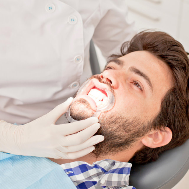 Clareamento Dental